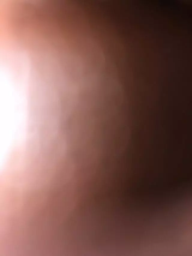 81