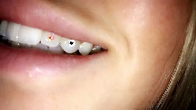 Bay Area Tooth Gems