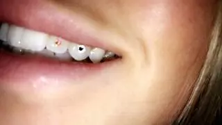 Bay Area Tooth Gems
