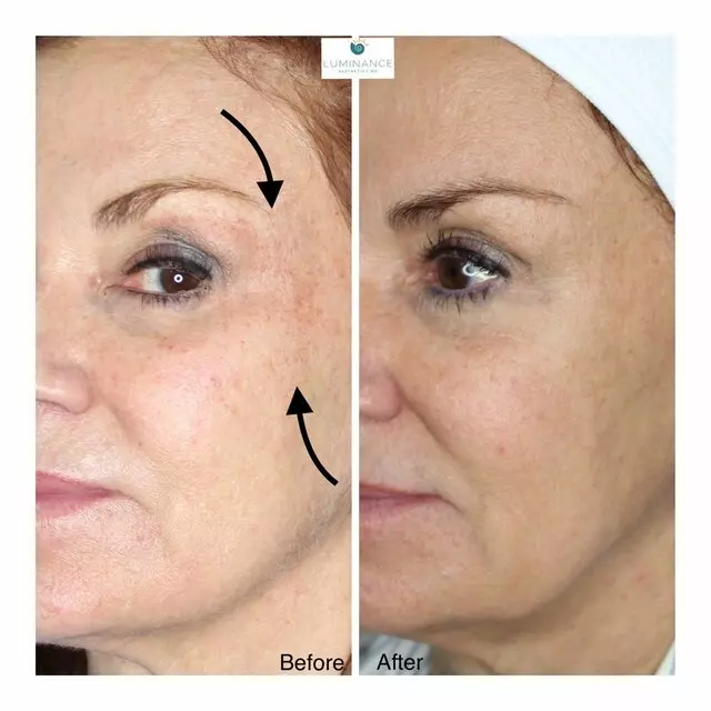 Anjali Dhar, MD - Luminance Aesthetics