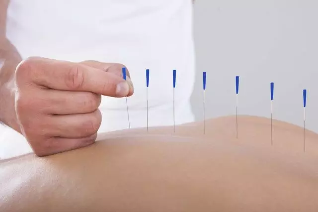 ACC Acupuncture and Cleansing