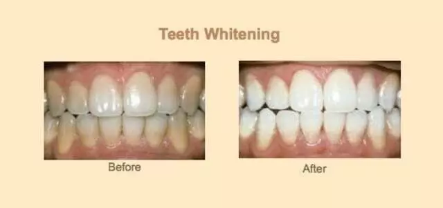 Avanti Dental Group