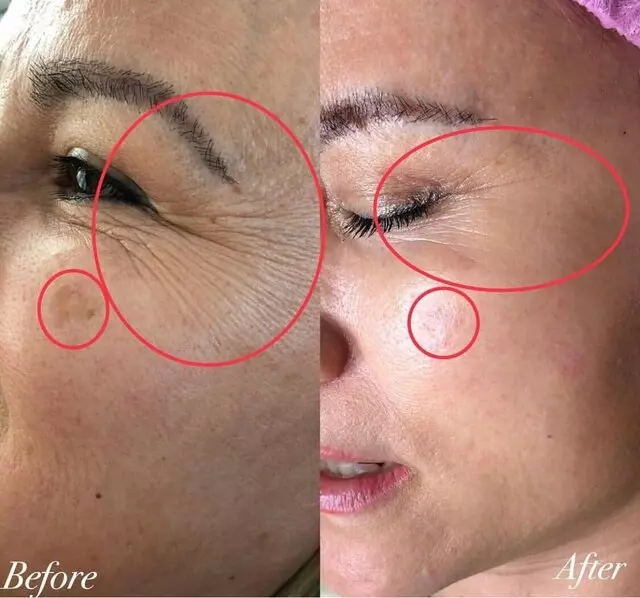 Impressive Beauty By Nhung