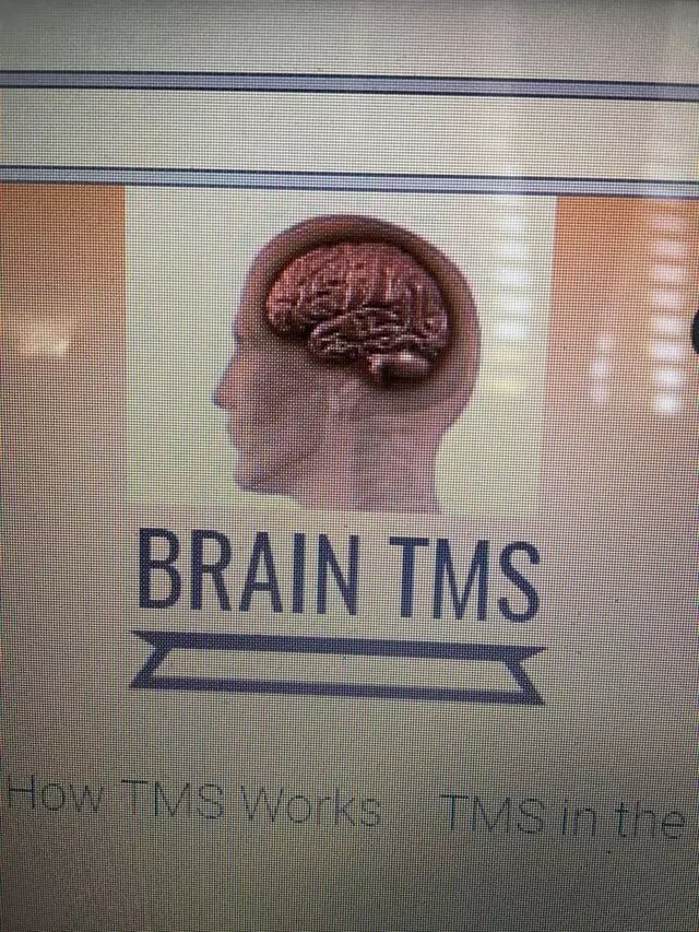 BrainTMS